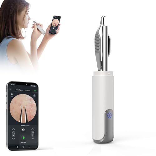 Blackhead Removal Tweezer with 1080p Camera, Ultimate Precision: Blackhead Removal with Camera - Perfect for Delicate Tasks! - - Eyebrow Tweezer, Pull White Hair (White)