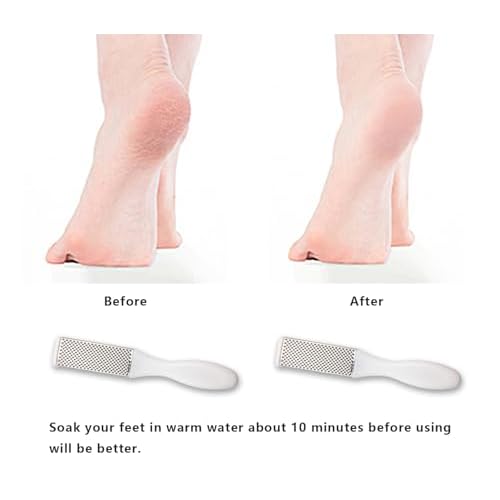 Professional Foot Files Callus Remover,Foot Scrubber for Dead Skin,Stainless Steel Foot Rasp-White(1 Pack)