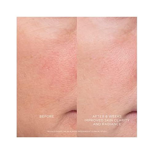 Hourglass Equilibrium Resurfacing Retinoid Treatment