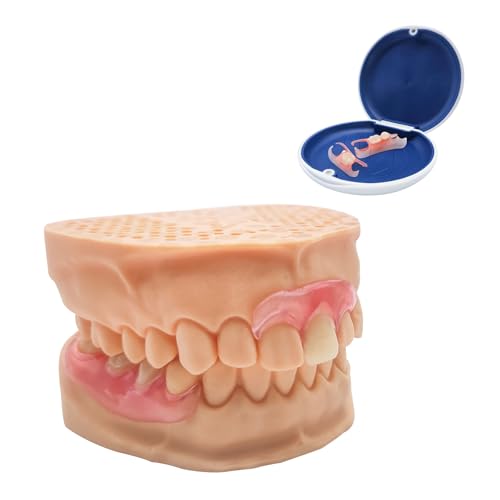Custom Partial Dentures ? Personalized Removable Denture Set for Missing Teeth | 1?6 Tooth Replacement with Storage Case | Natural Look & Comfortable Fit (2 Teeth)