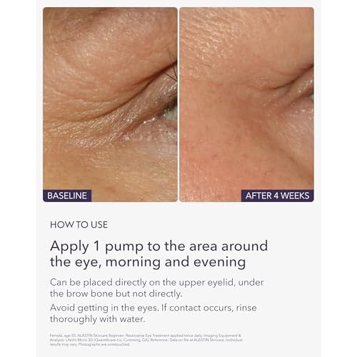ALASTIN Skincare Restorative Eye Treatment (0.5 oz) | Anti-Aging Eye Cream | Helps Reduce Dark Circles & Puffiness | Firming & Hydrating