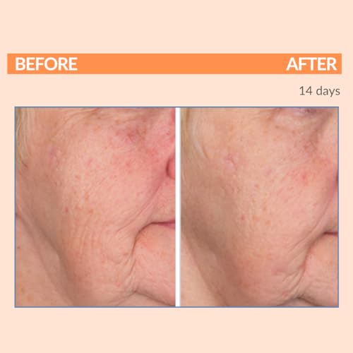Serious Skincare - Vitamin C Day & Night Skin Care Set - Brightening Face Serum, Daytime SPF Moisturizer, Restore Night Cream, Face Wash - C3 C Esters for Hydrating, Fine Lines and Wrinkles (4Pack)