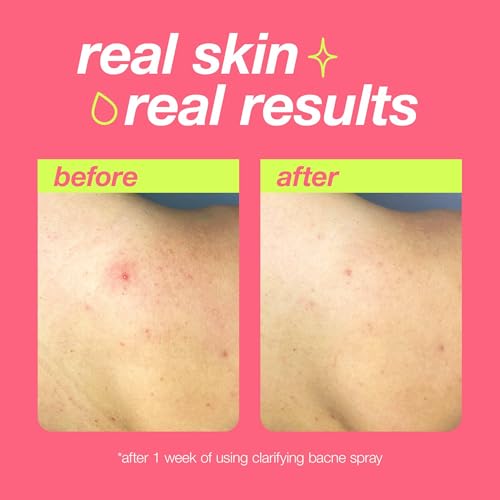Dermalogica Clear Start Clarifying Bacne Spray, Back Acne Treatment Spray for Body Breakout - Pore Clearing, Preventing Pimple with Salicylic Acid, Witch Hazel, Tea Tree Oil, All Skin Type, 6 fl oz