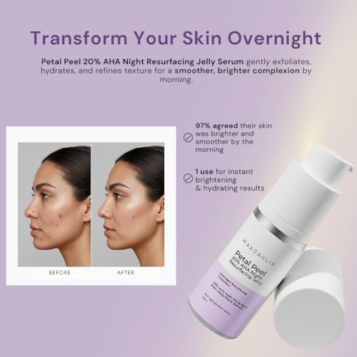 MAXDAHLIA Petal Peel - 20% AHA Serum | Mandelic & Lactic Acid | Resurfacing & Renewing Overnight Treatment for Dark Spots, Uneven Skin Tone & Acne Scar Remover