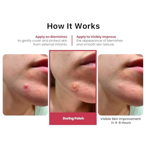 ROSELYNBOUTIQUE Pimple Patches for Face - Hydrocolloid Acne Patches For Zits Blemishes Pore Strips - Vegan Facial Skin Care Products Cruelty-Free (60 Dots)