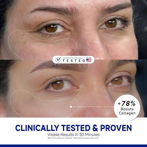 Peptide Under Eye Patches, Firming Eye Patches Instant Reduces Dark Circles and Puffiness, Collagen Under Eye Mask for Bags Treatment, Wrinkles, 60 Pairs