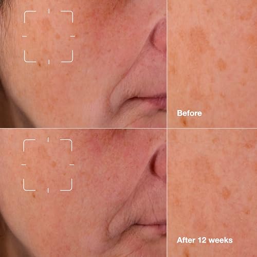 Clinique Even Better Clinical Dark Spot Clearing Vitamin C Face Serum For All Skin Types | Brightening + Soothing