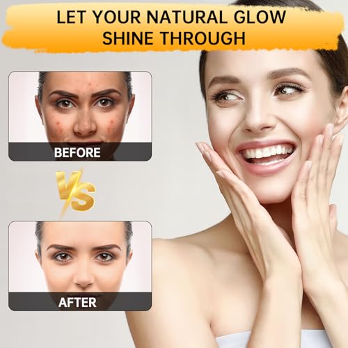 Kojic Acid Soap, Lemon Turmeric Soap Bar with Vitamin C for Dry Sensitive Skin, Turmeric Bar for Face, Body Hands 2 Bars