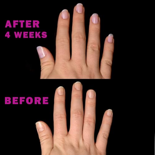 Perfect Formula Pink Gel Coat - Nail Strengthener and Strengthening Polish for Women, Extra Strong Nail Hardener, Keratin Treatment for Damaged Fingernails