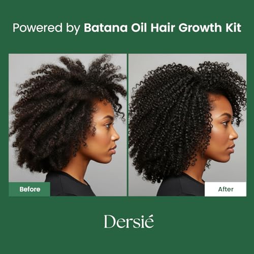 Dersie Batana Oil for Hair Growth Kit ? 100% Pure Batana Oil & Batana Shampoo Sourced from Honduras ? Promotes Hair Growth & Nourishes Scalp ? For Hair Loss, Thinning Hair, Dry, Damaged & Curly Hair