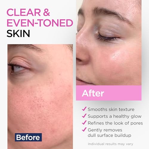 Glycolic Acid Serum for Face 15% - Extra Large Size (8 Oz) - Advanced Formula to Support Skin Radiance, Addressing Uneven Tone & Fine Lines