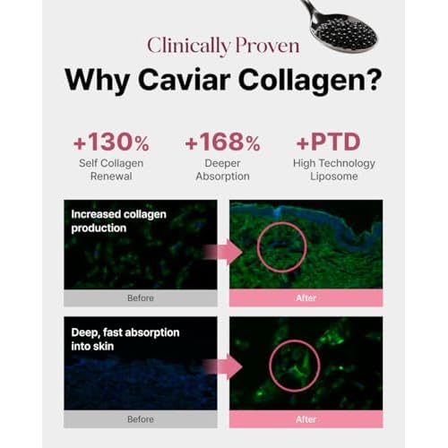 Delere Caviar Glow Dewy Cream | Hydrating Caviar Collagen Cream | Korean Hyaluronic Acid Moisturizer for Radiant Glass Skin, 1.7oz