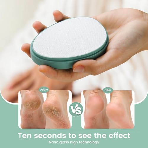 BEZOX Nano Glass Foot File Callus Remover with Cover ? Gentle Glass Foot Pumice Stone, Effective Feet Scrubber for Dead Skin, and Portable Pedi Egg Foot Care Tool - Green