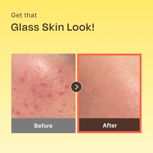 Celladix Banana PDRN 2X Serum ? 20,000 ppm High-Purity Vegan PDRN with Tranexamic Acid, Niacinamide & Alpha Arbutin ? Firming, Smoothing & Radiant Glass Skin Glow ? Korean Skincare, 1.01 Fl Oz