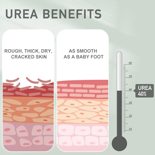 Urea Cream 40 Percent - Foot & Hand Cream for Dry, Cracked Heels, Feet, Knees, Elbows, and Hands - Maximum Strength Urea Lotion for Softening and Moisturizing