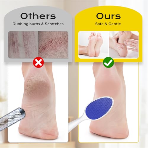 Foot File, Nano Glass Foot File Callus Remover with Handle, 2-in-1 Foot Scrubber Dead Skin Remover, Gentle Exfoliation Foot Buffer Pedicure Tools for Feet-Blue