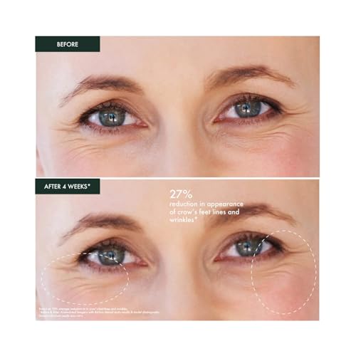R?Vive Renewal Under Eye Cream - Retexturizing Eye Cream for Wrinkles - Helps to Reduce Crow's Feet and Improve Skin Texture & Moisturization - Suitable for All Skin Types (0.5 oz)