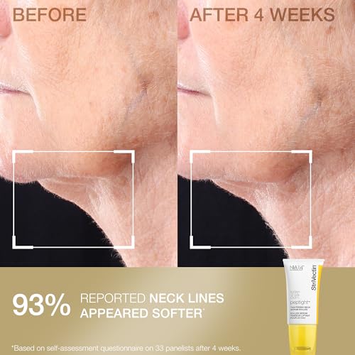 StriVectin Tighten & Smooth Neck Cream and Neck Serum Roller Anti-aging Skin Care 2-Piece Set, Smoothing Look of Wrinkles and Fine Lines, Improves Crepey Skin and Vertical Lines
