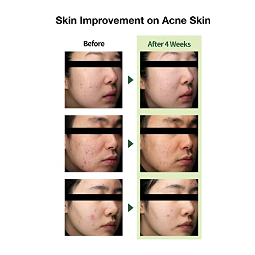 Lightweight Trouble Care Daily Moisturizer Watery Soothing Cream Centella Asiatica CICA Green Flavonoid - 1.7Oz Non-Clogging Oil Free Acne-Prone Skin Calm Redness Rosacea Korean THE LAB Blanc Doux