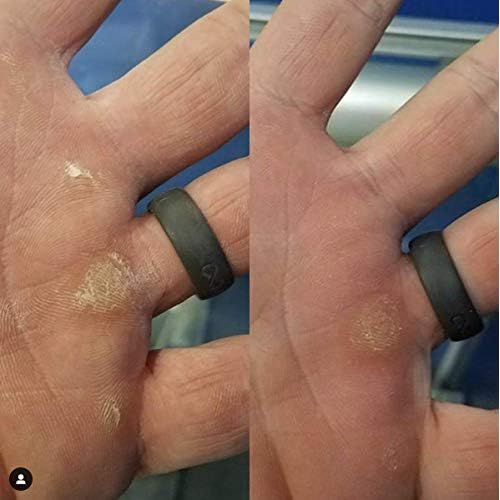 Callus Remover Handcare Kit - Perfect for Repairing Torn Hands from Gymnastics, Cross Fitness, Climbing (5in, Black)
