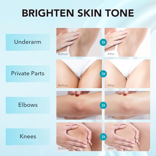 Skin Bleaching Cream, Skin Lightening for Intimate Areas, Moisturizing Cream Contain Vitamin C for Underarm, Armpit, Knees, Elbows, Inner Thighs and Bikini Area (1.7 Fl Oz)