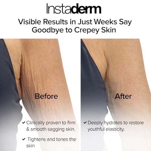 Crepe Fix Body Restorative Cream ? Anti-Aging Wrinkle Cream, Support Skins Natural Elastin & Collagen Production to Restore, Lift, Tighten, Hydrate & Smooth Thinning Aged Crepey Skin. 8OZ