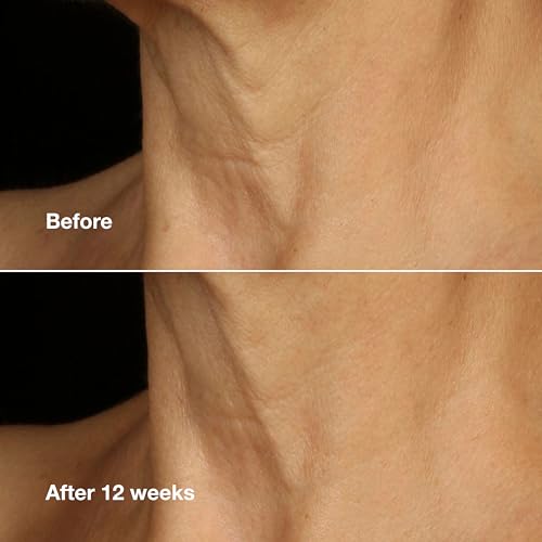 Clinique Smart Clinical Repair Anti Aging Lifting Face + Neck Cream with Peptides + Hyaluronic Acid For All Skin Types | Hydrating