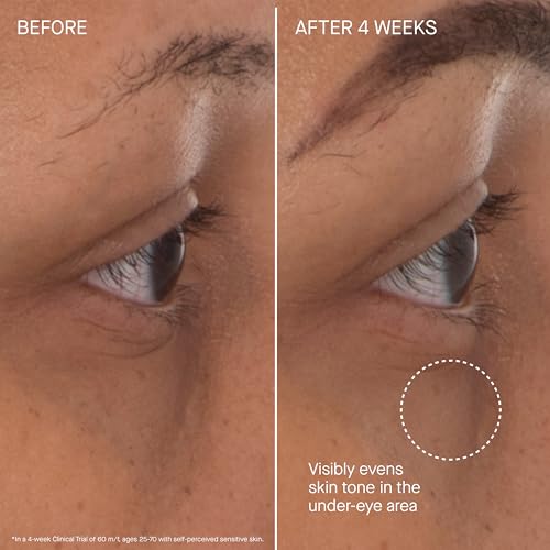 Augustinus Bader The Eye Patches ? Luxury Hydrating & Anti-Aging Under-Eye Treatment ? Reduces Puffiness, Smooths Fine Lines & Brightens Dark Circles ? Soothing, Restorative Formula