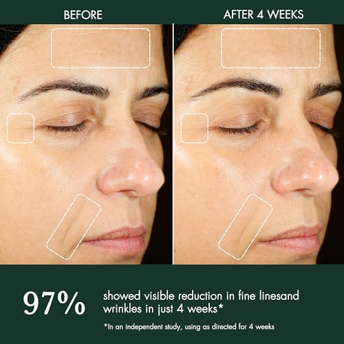 R?Vive Hydrogel Daily Face Moisturizer - Lightweight Water Cream & Peptide Moisturizer - Anti Aging Skin Care to Help Prevent Future Signs of Aging, Improve Fine Lines & Boost Skin Radiance (1.7 Oz)