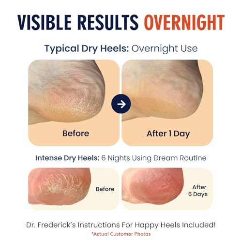Dr. Frederick's Original Moisturizing Heel Socks for Dry Cracked Heels Treatment - 6 Pairs - Infused with Naturally Nourishing Oils and Butters - Stocking Stuffers for Adults - Power Pack