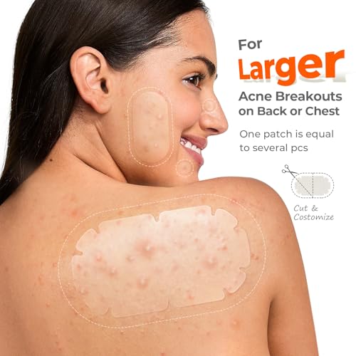 XXL Pimple Patches for Body, Large Hydrocolloid Acne Patches, 5 Sizes Big Hydrocolloid Bandages for Back, Chest, Shoulders Zit Breakouts, Blemish Stickers for Face (Oval, Dot 110 Count)