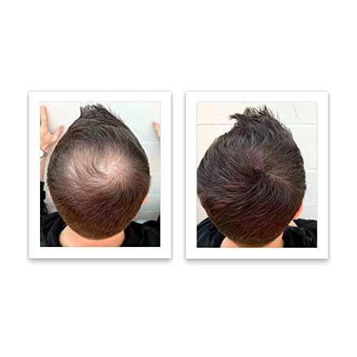 Caboki Hair Loss Concealer, 90-day supply, Dark Brown