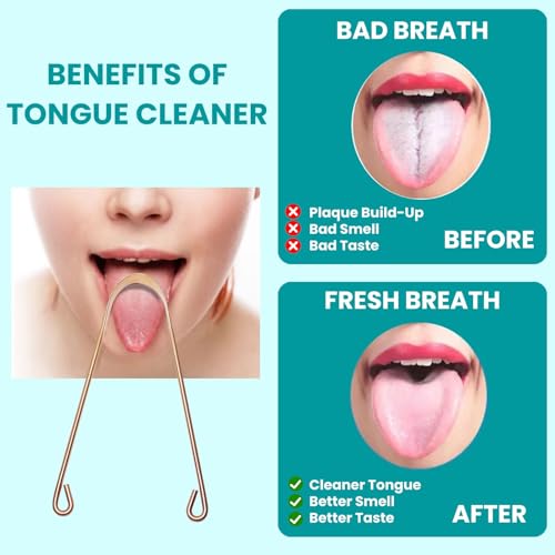 2Pcs Copper Tongue Scraper, Tongue Cleaner Set for Adults Kids, Stainless steel Wide Double Blades Oral Tongue Brush Cleaning Scrapping Sweeper for Fresh Breath and Mouth Hygiene Care with Travel Bag