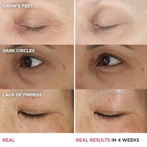 IT Cosmetics Confidence in an Eye Cream - Anti Aging Peptide Eye Cream for Dark Circles & Wrinkles, Lightweight 48HR Hydration, 2% Super Peptide Concentrate, Smooth & Brighten Undereye, All Skin Types
