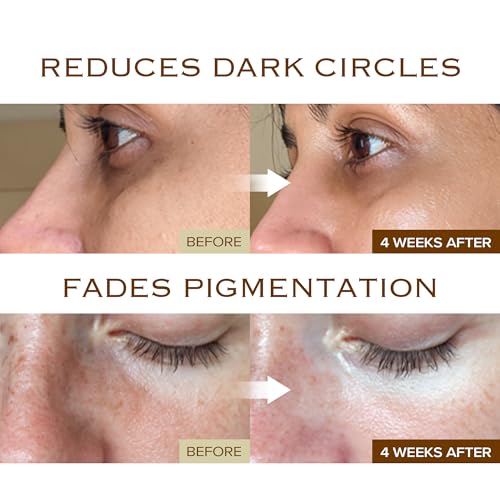 Dark Spot Ampoule | Korean Clinic Skincare - NAD+ 0.1% & Thioctic Acid 0.01% & Niacinamide 10% | Overnight Treatment for Melasma, Hyperpigmentation, Discoloration, Acne Scars | 15ml/0.33 Fl Oz