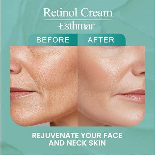 Retinol Face & Neck Cream ? Anti-Aging Night Moisturizer with Hyaluronic Acid, Vitamin E & Aloe Vera ? Reduces Wrinkles, Fine Lines & Dark Spots, Hydrating for All Skin Types