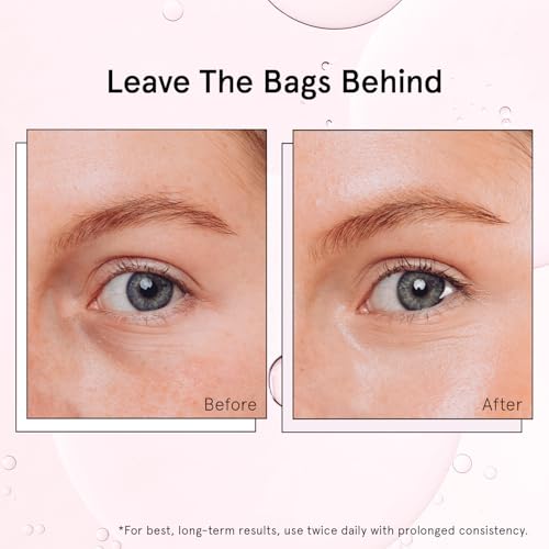 grace & stella Under Eye Brightener Roller - Airplane Travel Essentials - Travel Size Toiletries - Retinol & Caffeine Eye Serum for Puffiness, Dark Circles, Wrinkles - Vegan Skincare (15ml / 0.51floz)
