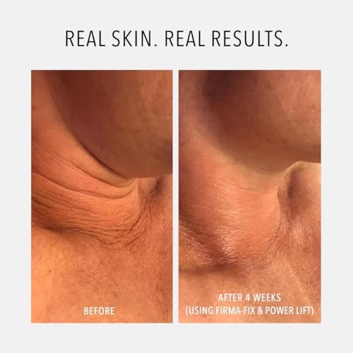 HydroPeptide Firm-A-Fix Nectar Lifting Neck & D?collet? Peptide Serum, 1.7 Ounce