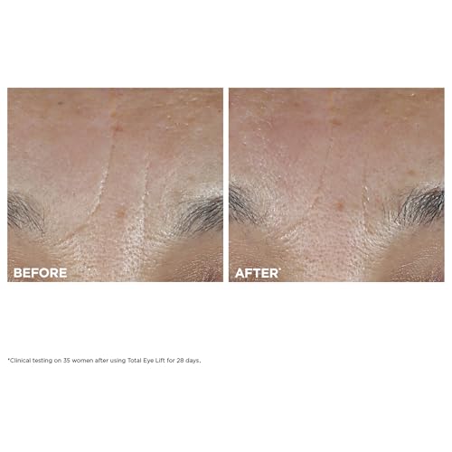 Clarins NEW Total Eye Lift | Anti Aging Eye Cream | Targets Wrinkles, Crow's Feet, Dark Circles and Puffiness For a Visible Eye Lift in 30 Seconds | REFILLABLE