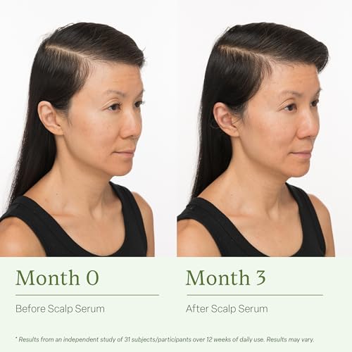 Divi Scalp Serum for Thinning Hair Clinically Tested, Non-Greasy Formula with Amino Acids, Caffeine & Rosemary Oil Promotes Healthy Scalp & Fuller-Looking Hair, Reduces Oil & Product Buildup