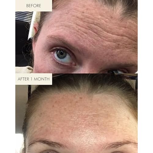MARA - 1.2% Clean Retinol Face Oil for Anti-Aging + Wrinkles with Algae + Green Tea | Vitamin-Rich Serum to Plump Skin Overnight, For All Skin Types (1 fl oz | 30 ml)