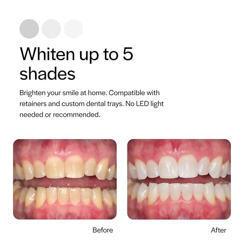 Opalescence 35% CP Mint - Gel Syringes Teeth Whitening - Refill Kit (4 Syringes Total) Carbamide Peroxide Gel. Made by Ultradent. Tooth Whitening Refill Syringes 5197-2