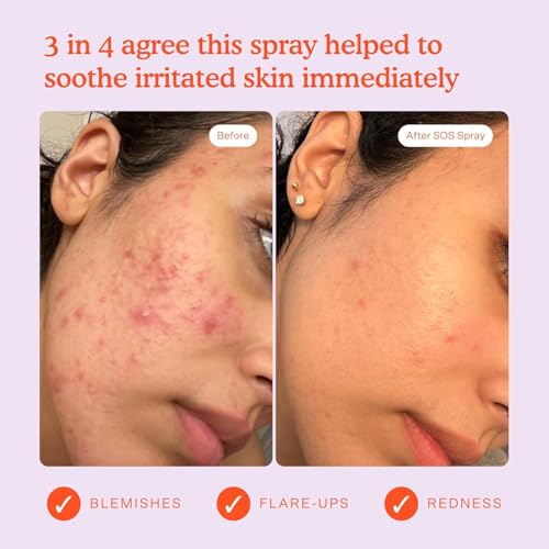 Tower 28 SOS Daily Rescue Spray Duo for Sensitive Skin, Hypochlorous Acid Spray Helps Reduce Redness and Breakouts, Full Size and Travel Size