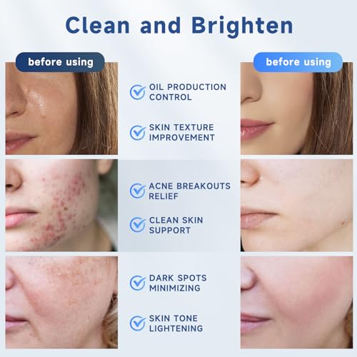 Glycolic Acid Pads, Exfoliating Resurfacing Pads for Face with Salicylic Acid Pad with Tea Tree Oil, Exfoliating Face Peel & Radiance Deep Cleaning Effect, 60 Count
