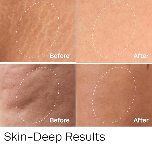 Hot Vita Vitamin C Body Oil ? Hydrating & Firming Natural Blend with Rosehip & Cypress Oils ? Evens Skin Tone, Reduces Cellulite Appearance, Boosts Radiance & Promotes Collagen Production
