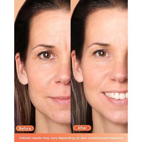 NEWKEY Red Light Therapy Mask for Face,7 Colors LED Face Mask Light Therapy, At-Home Photon Skin Care Beauty Mask for Anti Wrinkles Acne Reduction