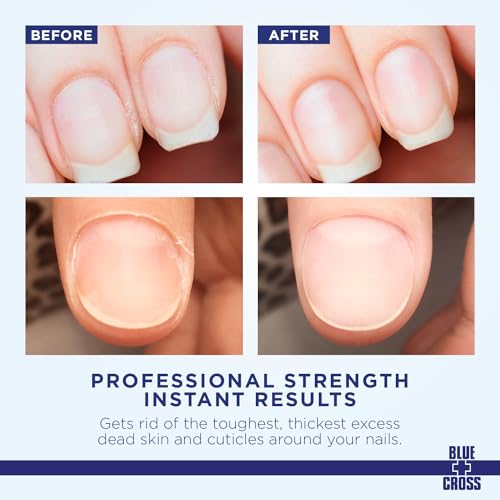 Cuticle Remover & Softener Liquid for Nails ? Blue Cross Professional Nail Care with Lanolin, Hydrating Treatment for Dry Cuticles & Hangnails, Made in USA, 8oz