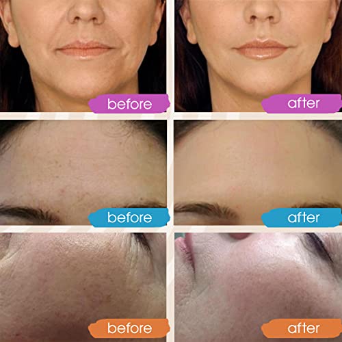 GLEOW Retinol Serum for Face, Vitamin C with Hyaluronic Acid Face Serum for Women and Men, Glow Total Package Skin Care Set, Targets Appearance of Uneven Skin Tone and Dryness 3x2 oz