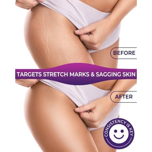 Body Firming Oil, 3.4 FL OZ Body Oil After Shower ? With 790,000ppm Tightening Oil(Grape Seed Jojoba Sweet Almond) &10,000ppm Hyaluronic Acid ? Fast-Absorbing For Hydrating Full Body, Lavender
