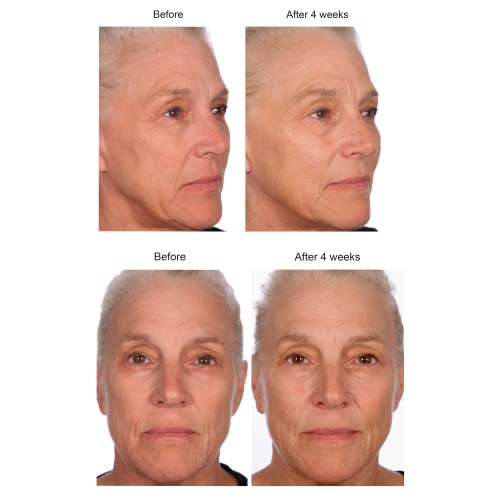 Serious Skincare - Black Pearl Deep Wrinkle Decrease Face Serum - Repair Deep Lines & Wrinkles - Increases Skin Hydration & Elasticity - Radiance Boosting for Luminous Glowing Skin 1 Fl. Oz.